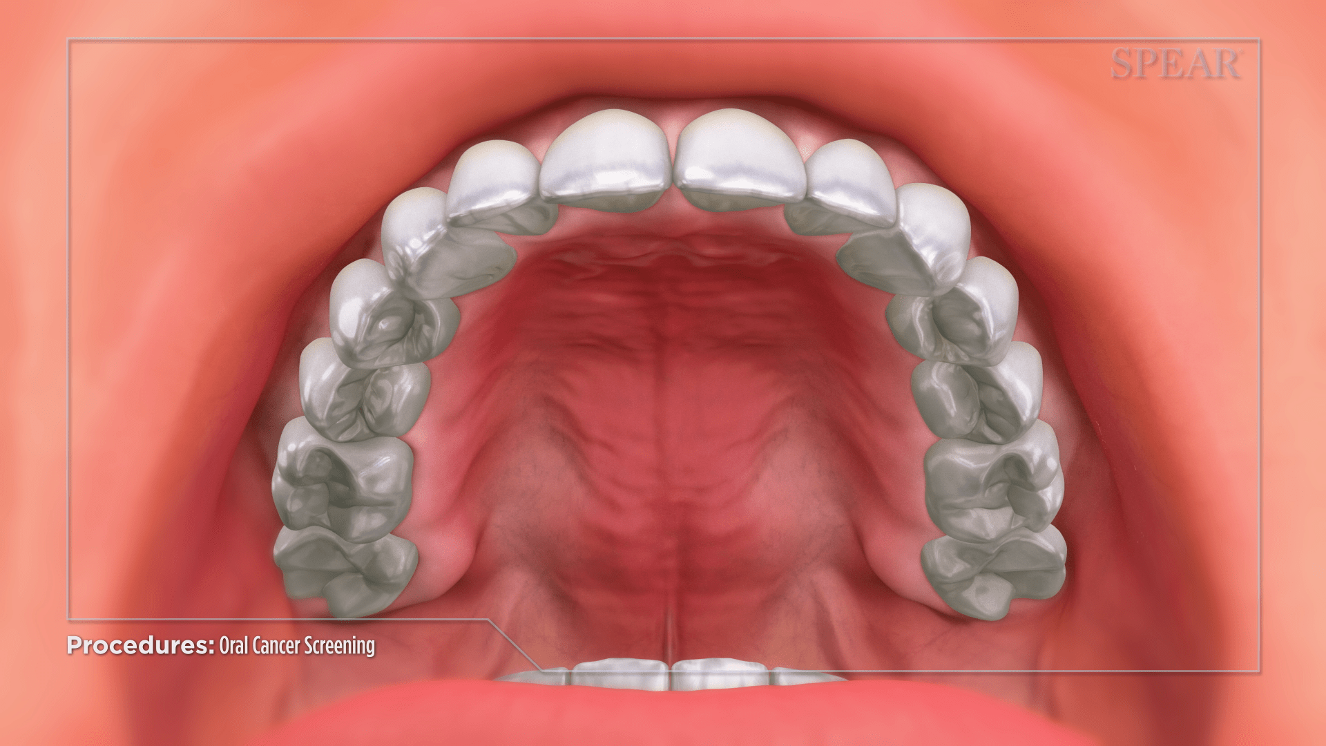 Oral Cancer Screening by Cambridge Dental Associates