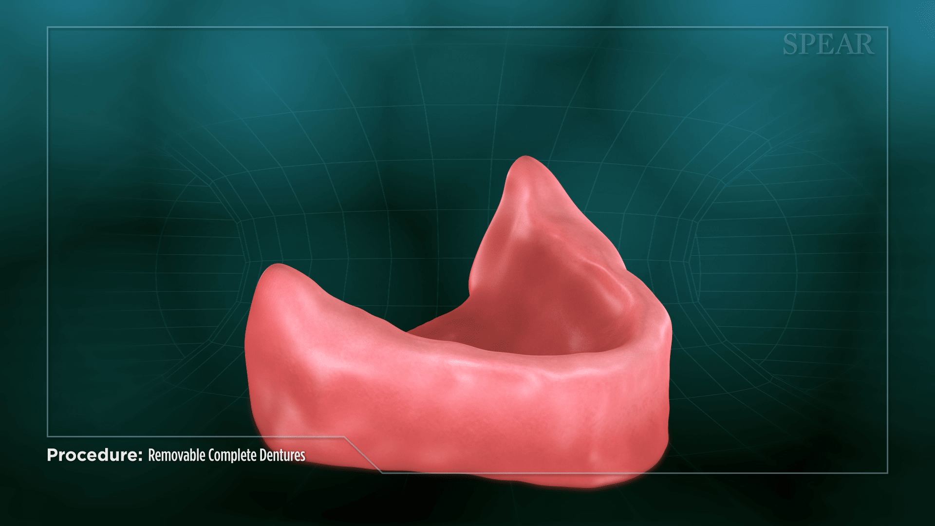Upper and Lower Teeth Replacement in Greenwood, SC